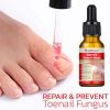 NailHelper Ingrowth Toenail Correction Treatment Oil